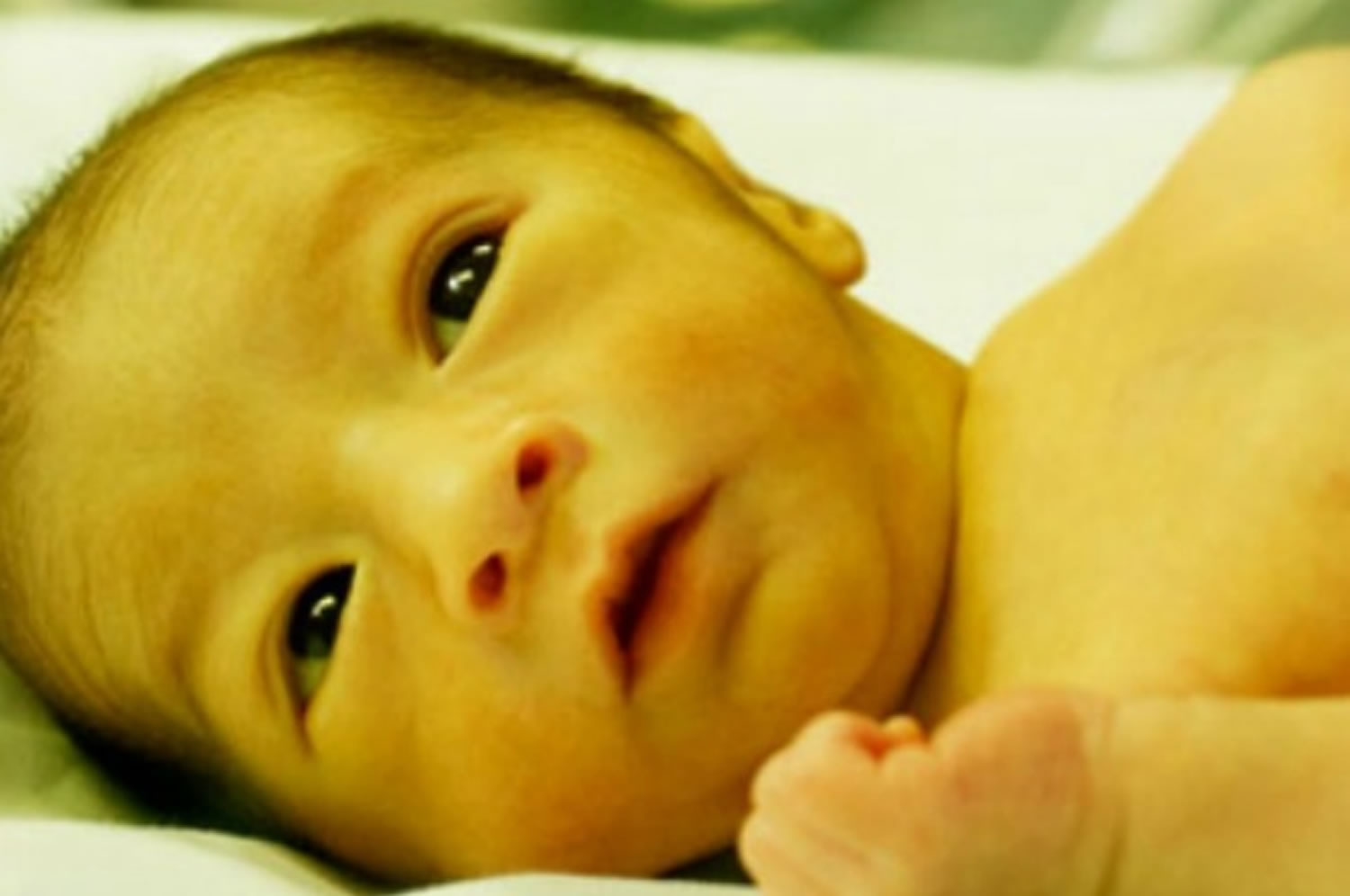 علاج اليرقان عند حديثي الولادة
