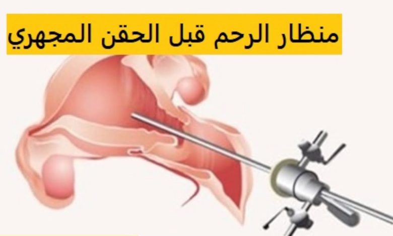4 توجيهات ما قبل عملية تنظير عنق الرحم