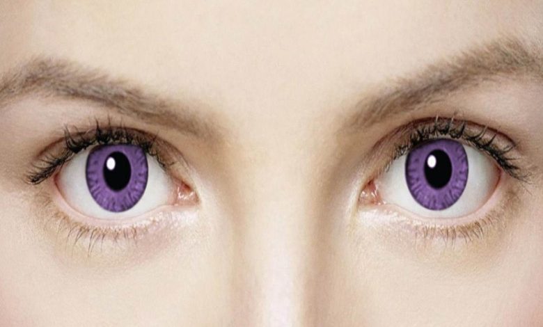 ما هي متلازمة أليجاندريا حالة نادرة من العيون البنفسجية