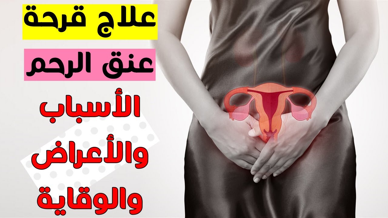 هل قرحة الرحم تمنع الحمل