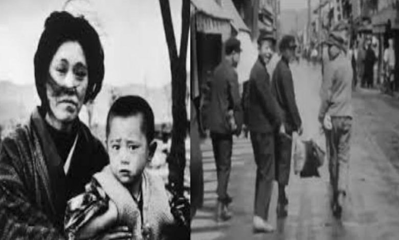 كيف كان شكل اليابانيين قبل قنبلة هيروشيما